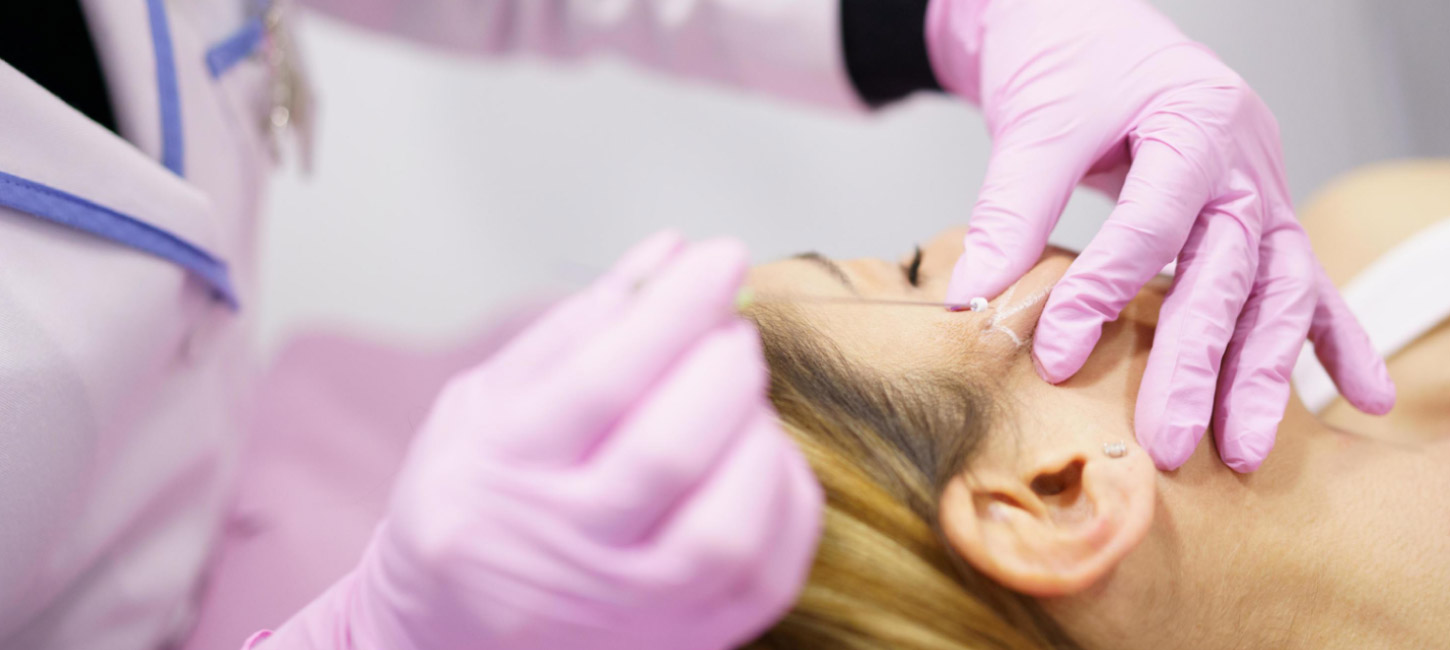 Fios de PDO Clínica Estética Porto Alegre Moinhos de Vento