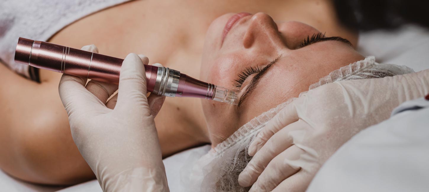 Microagulhamento Porto Alegre Clínica Estética